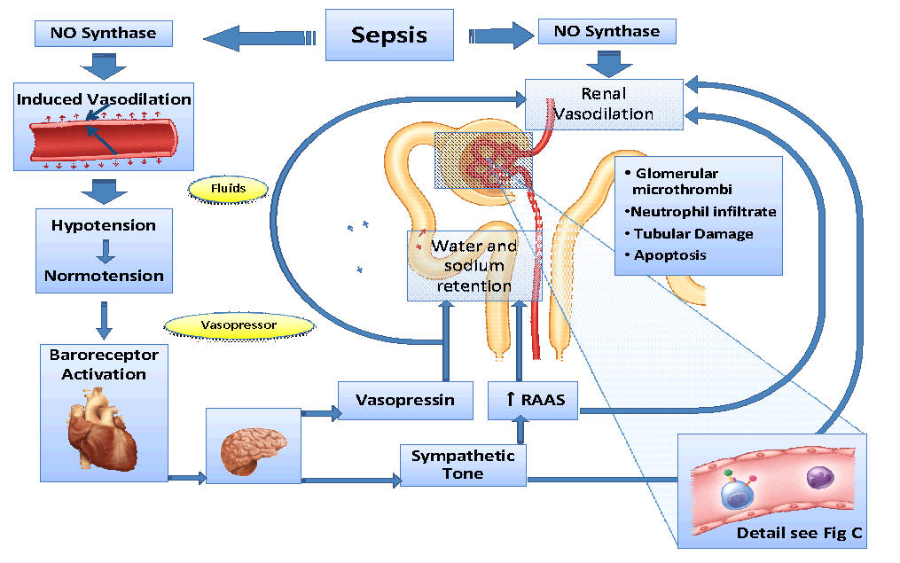 Sepsis leading to Septic Shock